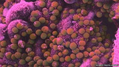 cryptosporidium bacteria cryptosporidium bacteria