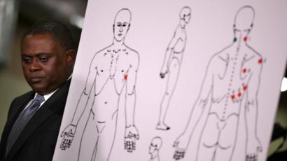 Dr. Bennet Omalu stands by a diagram showing the results of his autopsy of Stephon Clark