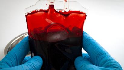 De Definición de sangre en la ciencia coágulo
