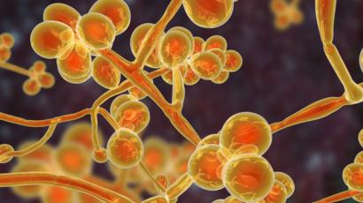 cómo prevenir la infección por cándida cómo prevenir la infección por cándida