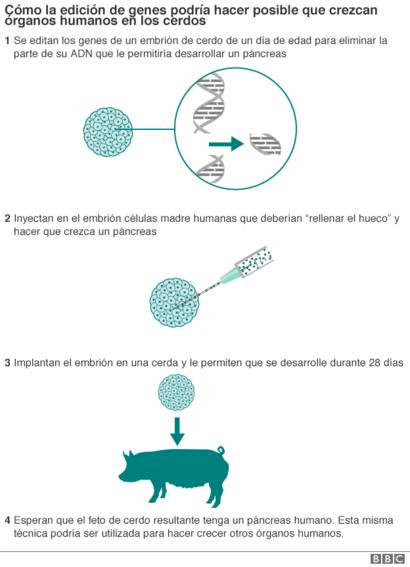 tenia de cerdo en los ojos tenia de cerdo en los ojos