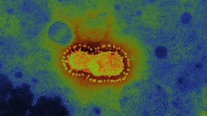 Le coronavirus sous le microscope