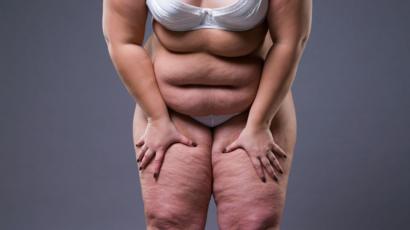 Gorda tratando de perder peso Gorda tratando de perder peso