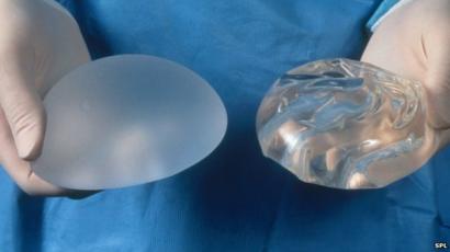 Cosmetic and Plastic surgery _72681775_c0124133-breast_implants-spl