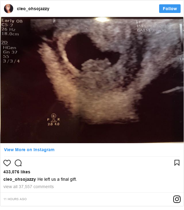 Xxxtentacion S Girlfriend Is Pregnant Bbc News