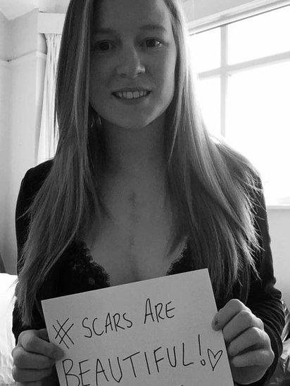 A photo of becky holding a sign saying 'scars are beautiful' displaying her scar