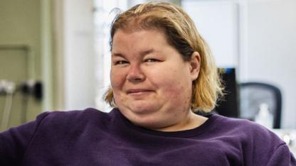 Women with learning disabilities star in menopause film