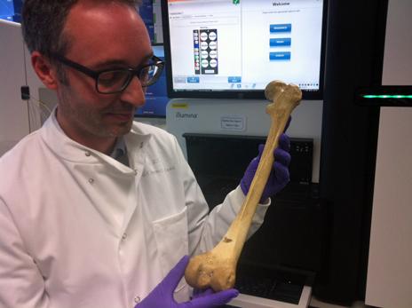 Michael Simpson holds a femur of a similar age to Merrick's