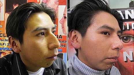 Facial Plastic Surgery Procedures - Uassex