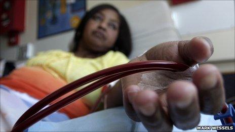 A patient receiving kidney dialysis
