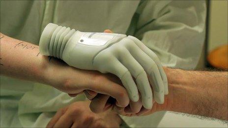 Milo is measured up using his bionic hand prior to the operation
