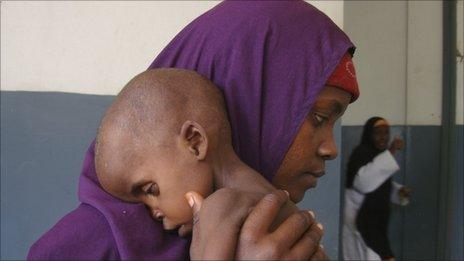 A malnourished child from southern Somalia is carried by his mother at a hospital in Mogadishu