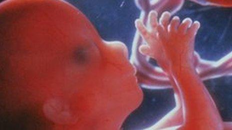 A foetus at around 12 weeks old