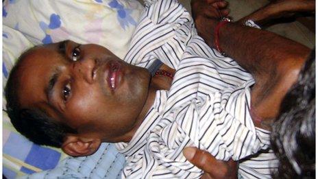 A victim of the toxic alcohol in Orissa being taken to hospital on 8 February 2011