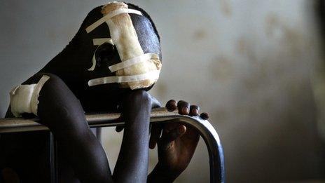 Victim of LRA in Uganda (file photo)