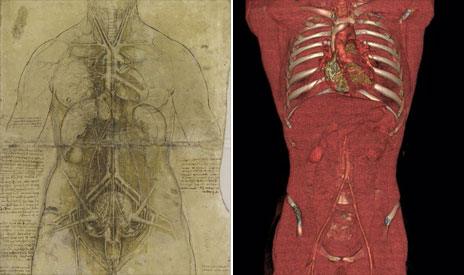 Da Vinci sketch of a torso and a CT image of one
