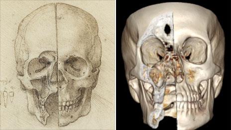 Da Vinci sketch of a skull and a CT image of one