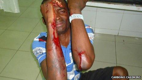 One of the group of rappers injured in Luanda on 22 May 2012