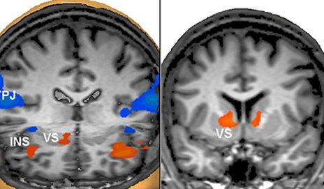 MRI scan results