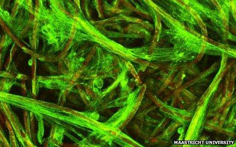 Muscle cells in 'scaffold'