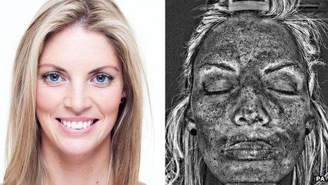 A model alongside an image of her damaged skin detected by the UV scanner