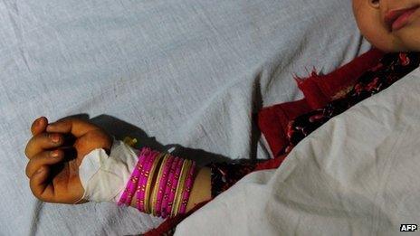 A five year old Afghan girl who was allegedly raped by a 22 year old man lies in a hospital bed