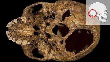 Base of Richard III's skull
