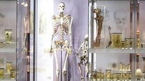 Skeleton of Charles Byrne