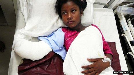 Aana, the girl whose hand was amputated
