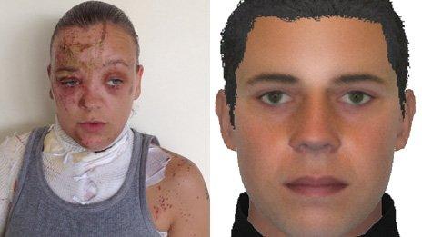 Acid attack victim, left, and person police are seeking