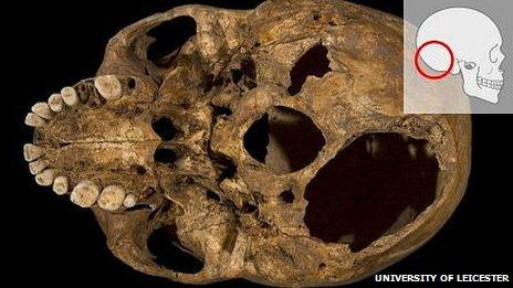 Base of Richard III's skull