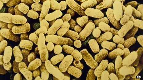 Electron microscope image of E coli