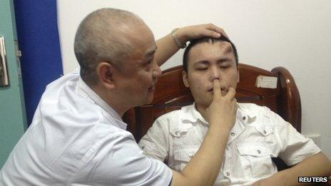 A doctor checks the damaged nose of Xiaolian