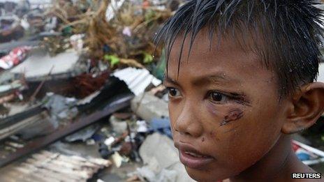 Injured boy stands in ruins of family home - 10 November