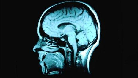 Imaging of human brain