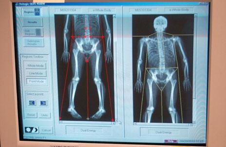 Dexa images on screen