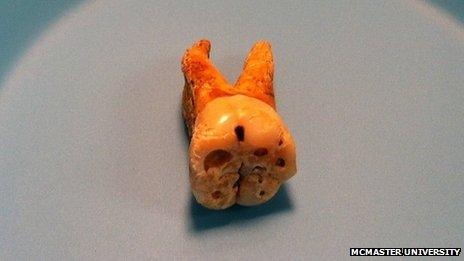 A tooth from a victim of the plague