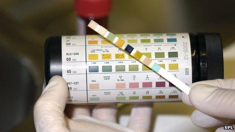 testing for blood in a urine sample