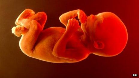 human foetus