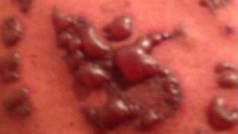 Your Pictures Tattoos You Regret And Would Remove Bbc News