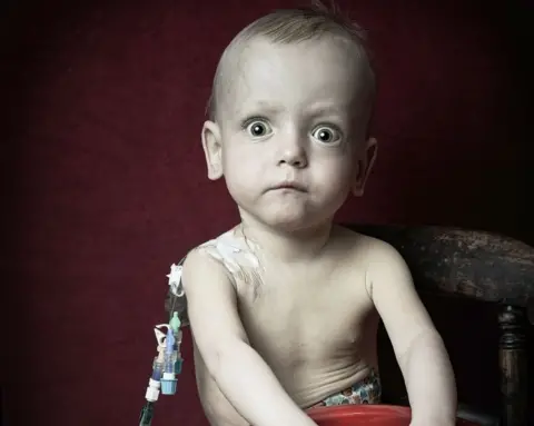 Debbie Todd A young boy with tubes attached to his body stares at the camera