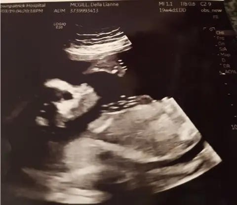 Della McGill baby scan