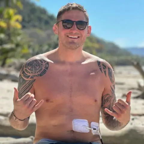 Rhys Thomas Rhys smiling while sitting on a tree trunk on a tropical beach. He has his top off and his hands out in front of him. Two white plasters can be seen on his stomach which has a tube coming out of. A faded large red scar can be seen by his heart. He wears black sunglasses and has short dark brown hair. He has large tribal tattoos on both s