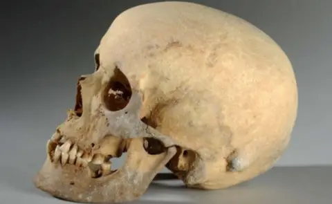 Leeds Museums and Galleries The Skull of the Iron Age woman