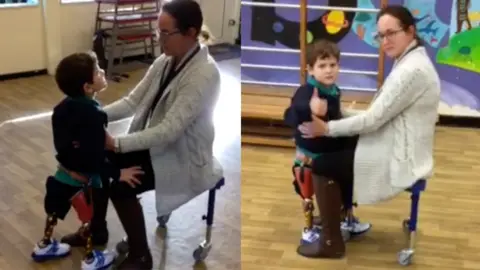 Family handout Romeo walking on his prosthetics