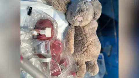 University Hospitals Sussex NHS Foundation Trust A premature baby receiving treatment. There is a plush rabbit next to her.