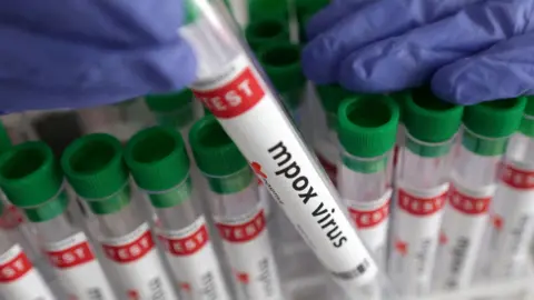 A test tube labelled "mpox virus positive" is held in this illustration taken August 20, 2024