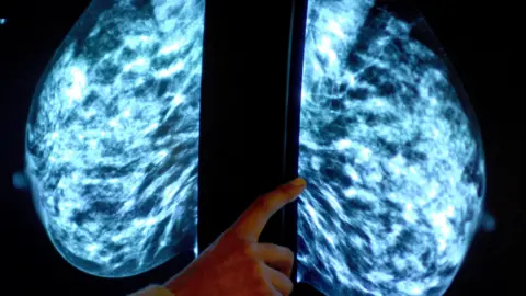 Someone points at a breast scan on a screen. 