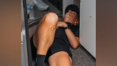 Matt Stone Esmée Gummer, wearing black sport clothing, lying on the floor of a van. She has a large blister under her knee. 