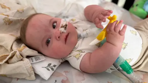 Teddy is lying in his cot, holding a banana-shaped teething toy. His feeding tube is taped to his left cheek, and you can see his tracheostomy tube coming out from under his chin and attached to a transparent tube with green joints, which rests under his arm. Teddy is wearing cappuccino coloured leggings and a cream bodysuit with animal patterns.